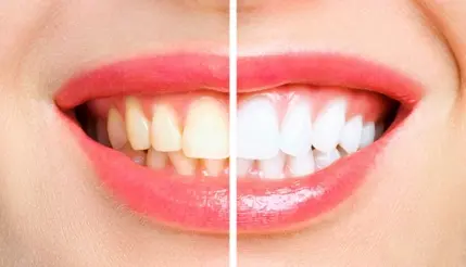 Centro dental en la pintana