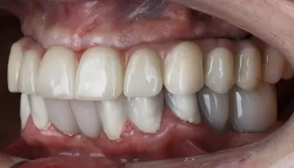 Centro dental en la pintana