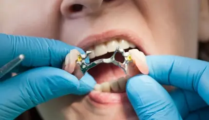 Centro dental en la pintana